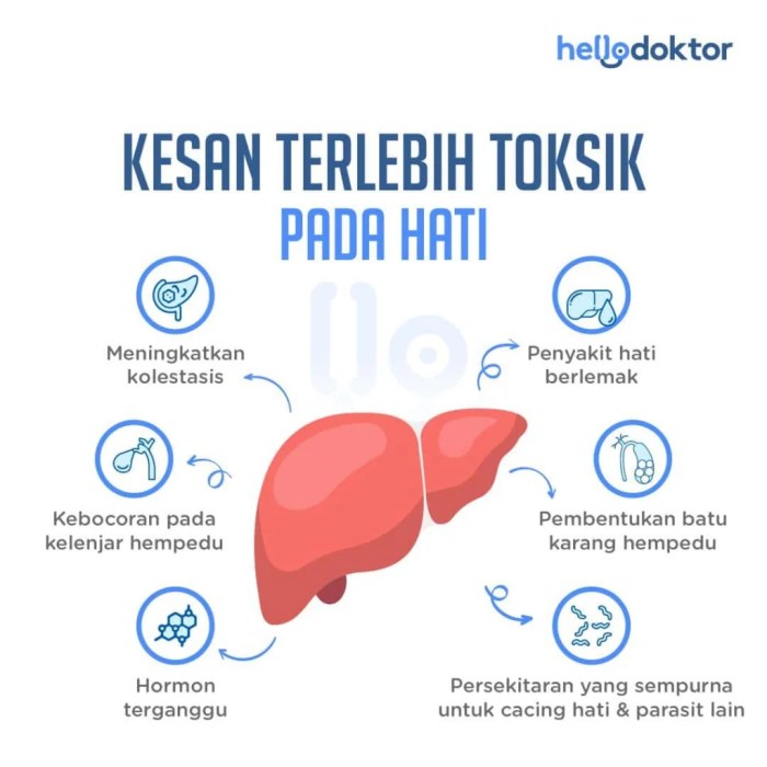 Organ hati membantu pembersihan bisa Makanan yang Baik untuk Fungsi Hati