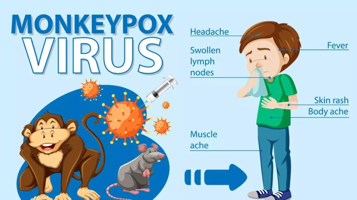 Gejala Cacar Monyet (Monkeypox), Penyebab & Pencegahan. Darurat!
