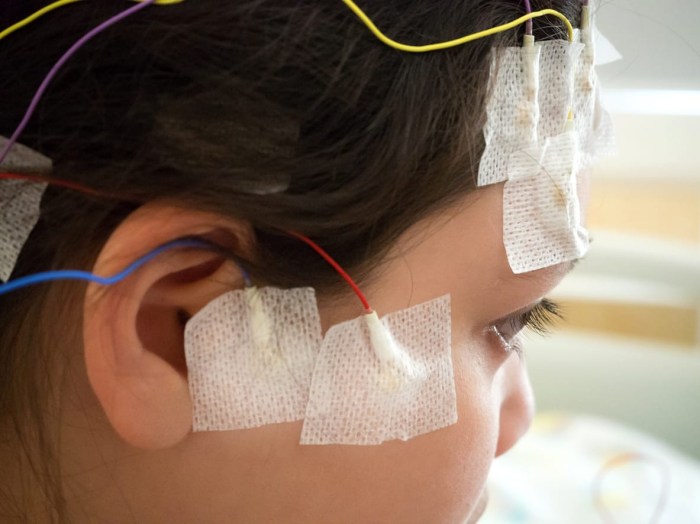 Anak Penderita Epilepsi Temukan Harapan Lewat Terapi Musik