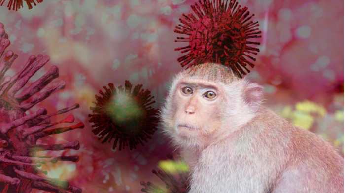 Gejala Cacar Monyet (Monkeypox), Penyebab & Pencegahan. Darurat!