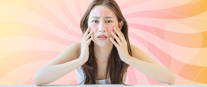 Hidup dengan Lupus: Cerita Inspiratif Seorang Remaja