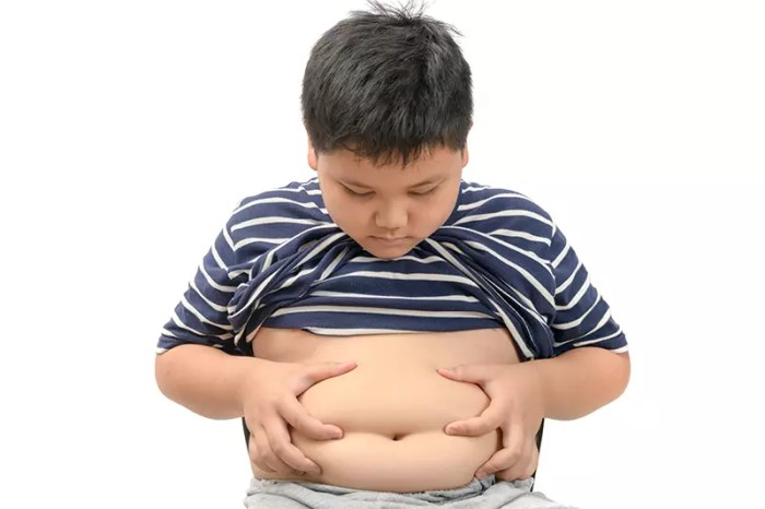 Fakta: Indonesia Masuk 10 Negara dengan Obesitas Anak Tertinggi