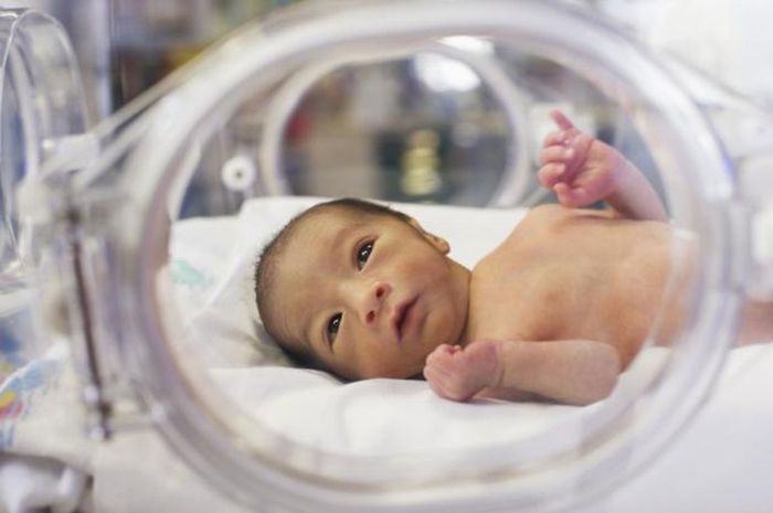 Bayi Lahir Prematur Kini Tumbuh Menjadi Anak Berprestasi