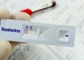 Warga Kulon Progo Suspek Virus Hanta Dinyatakan Tidak Terinfeksi