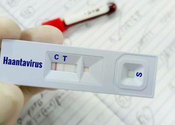 Warga Kulon Progo Suspek Virus Hanta Dinyatakan Tidak Terinfeksi