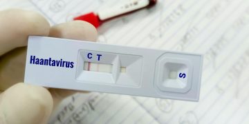 Warga Kulon Progo Suspek Virus Hanta Dinyatakan Tidak Terinfeksi