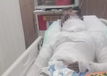 Sopir Truk Bali yang Dibakar Meninggal Dunia setelah Seminggu Kritis