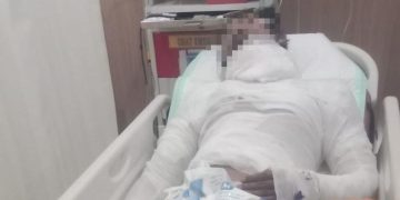 Sopir Truk Bali yang Dibakar Meninggal Dunia setelah Seminggu Kritis